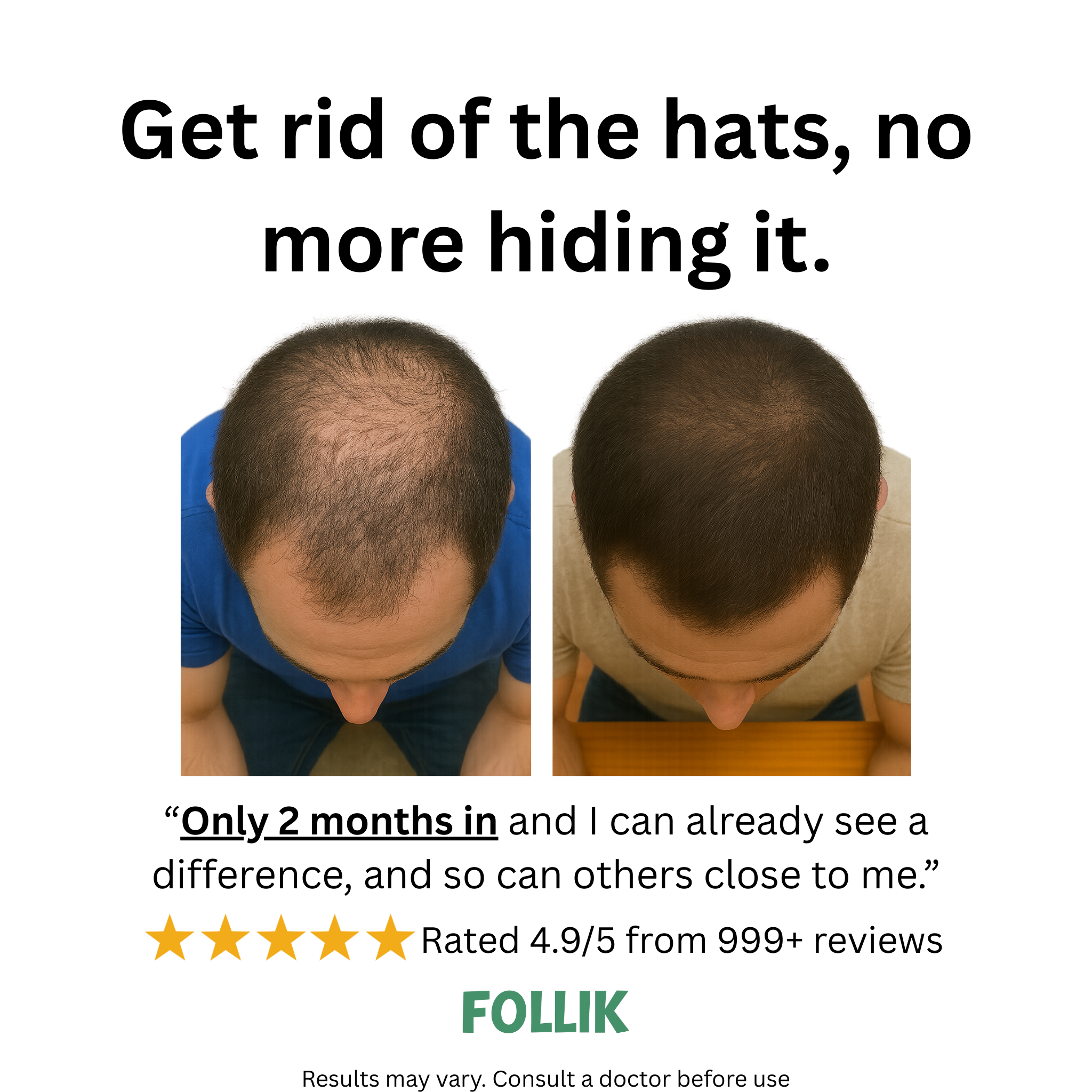 FOLLIK - Premium Hair Recovery & Growth Serum (RU58841+Minoxidil) (60ml)